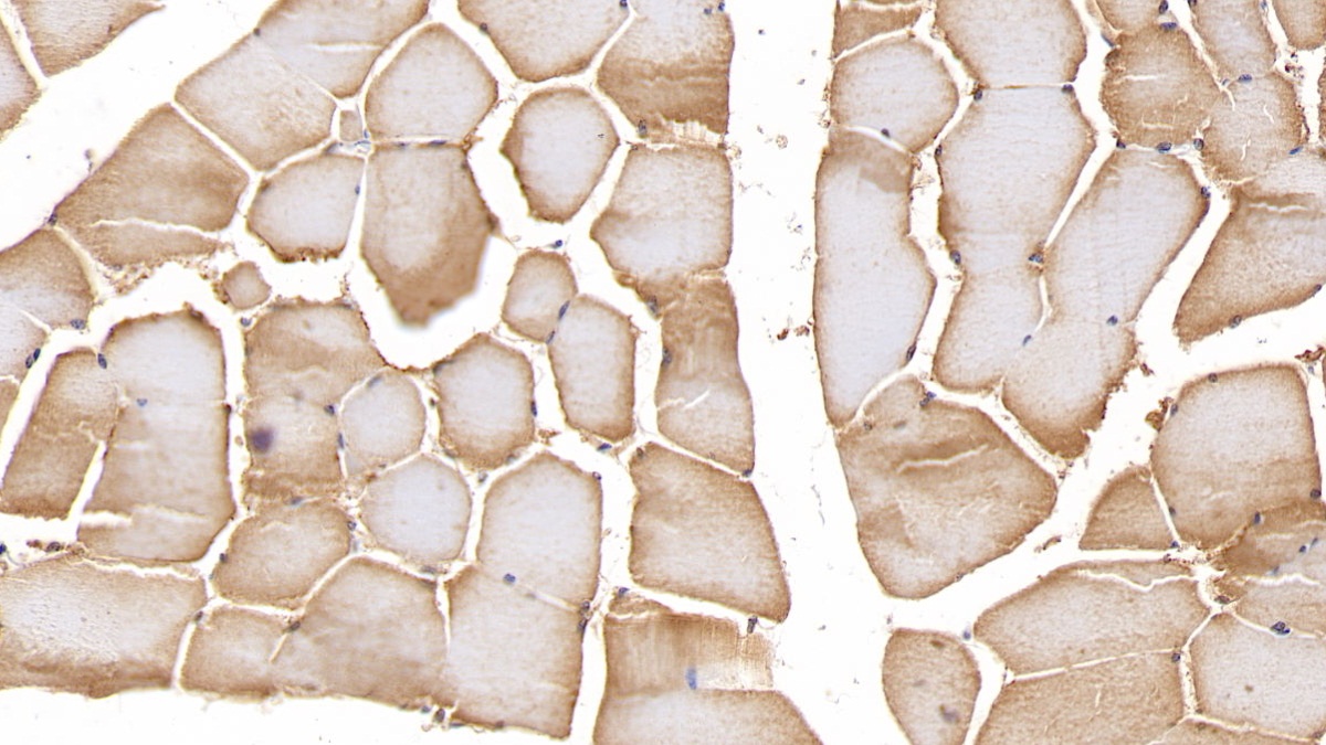 Polyclonal Antibody to Matrix Metalloproteinase 2 (MMP2)