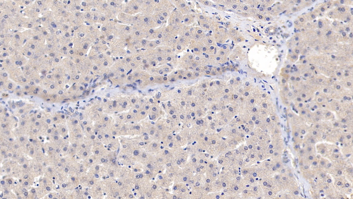 Polyclonal Antibody to Matrix Metalloproteinase 2 (MMP2)