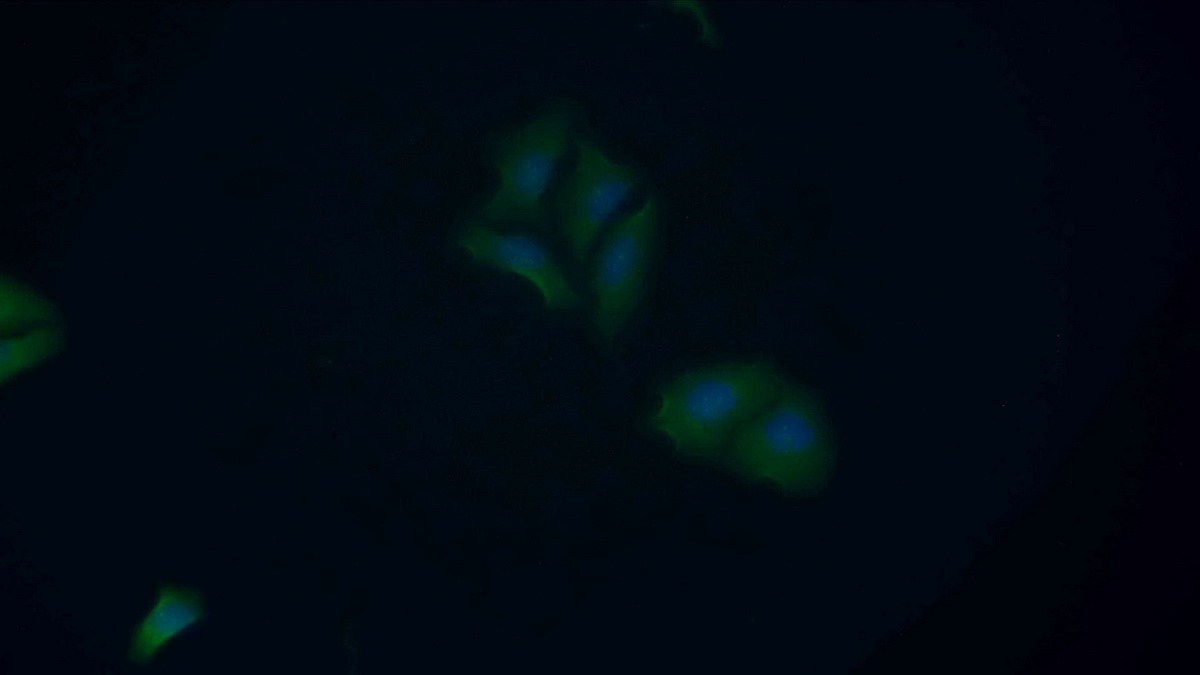 Polyclonal Antibody to Matrix Metalloproteinase 2 (MMP2)