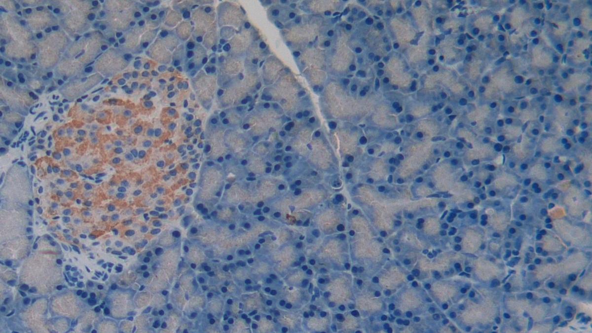 Polyclonal Antibody to Matrix Metalloproteinase 3 (MMP3)