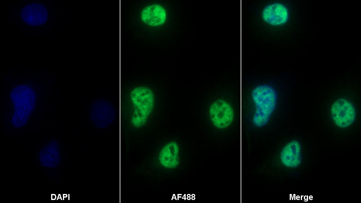 Polyclonal Antibody to Matrix Metalloproteinase 7 (MMP7)