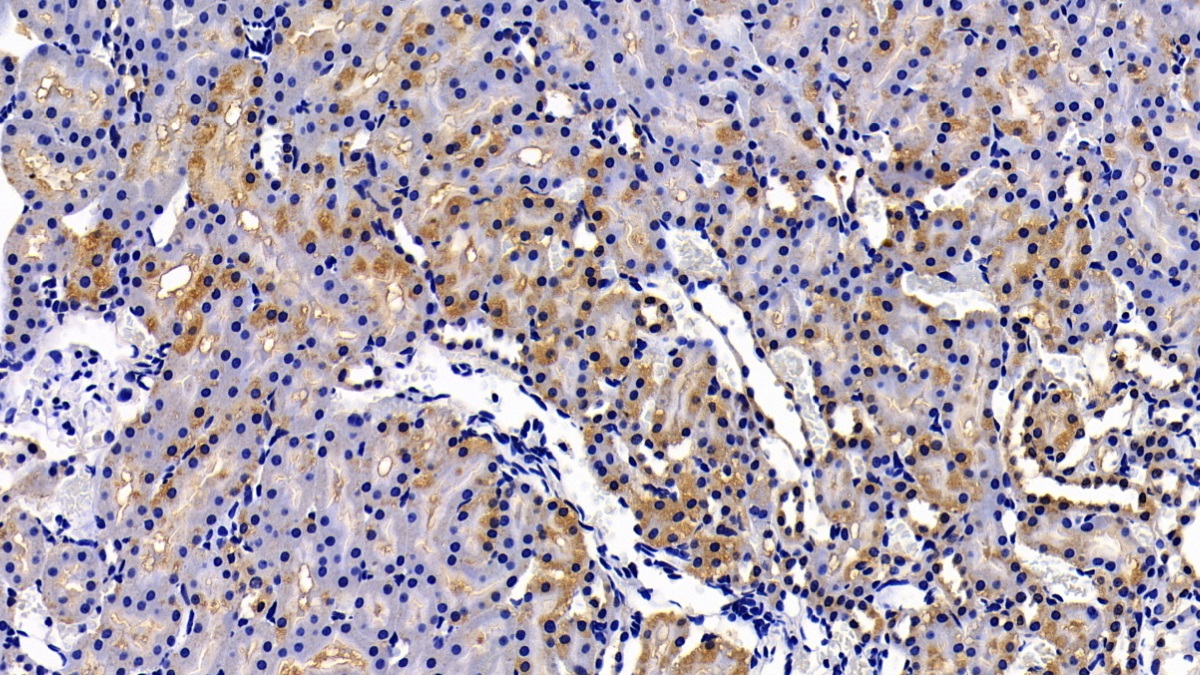 Polyclonal Antibody to Matrix Metalloproteinase 7 (MMP7)