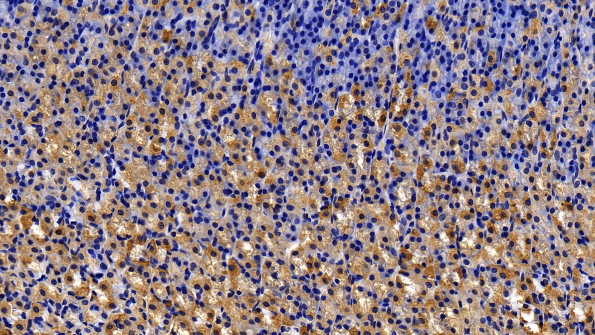 Polyclonal Antibody to Matrix Metalloproteinase 7 (MMP7)