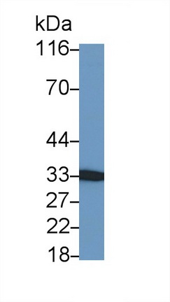 Polyclonal Antibody to Nerve Growth Factor (NGF)