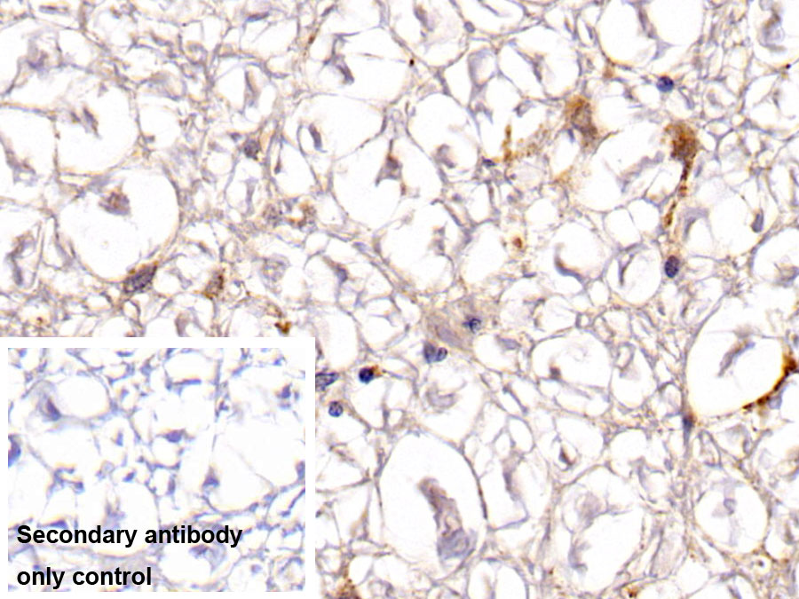 Polyclonal Antibody to Nerve Growth Factor (NGF)