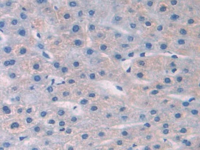 Polyclonal Antibody to Nerve Growth Factor (NGF)