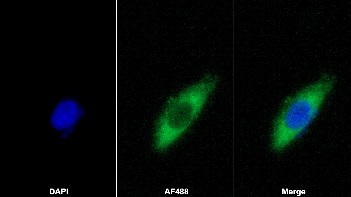 Polyclonal Antibody to Nerve Growth Factor (NGF)