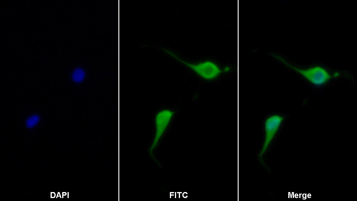 Polyclonal Antibody to Nerve Growth Factor (NGF)