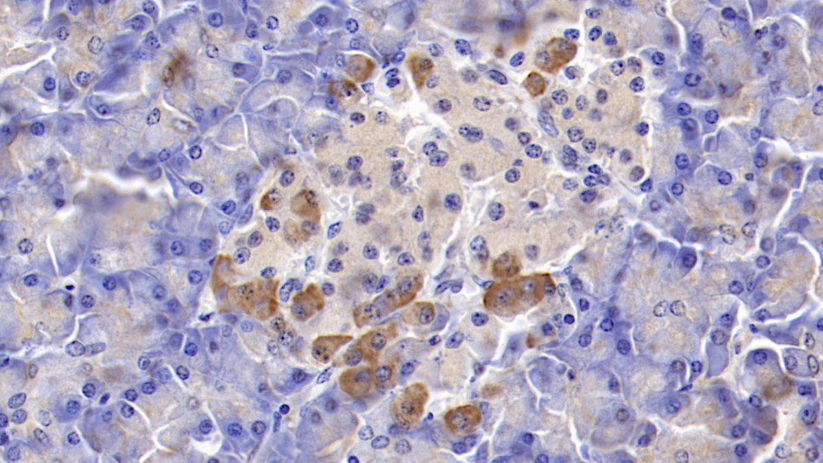 Polyclonal Antibody to Osteoprotegerin (OPG)