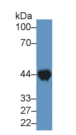 Polyclonal Antibody to Creatine Kinase, Muscle (CKM)