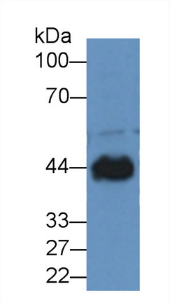 Polyclonal Antibody to Creatine Kinase, Muscle (CKM)