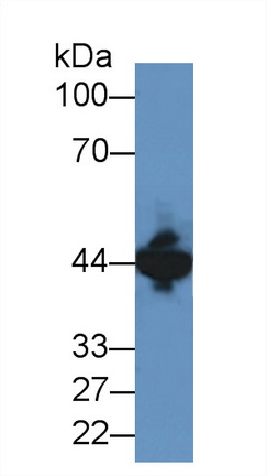 Polyclonal Antibody to Creatine Kinase, Muscle (CKM)