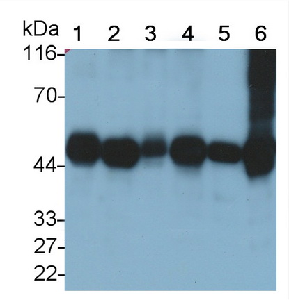 Polyclonal Antibody to Creatine Kinase, Muscle (CKM)