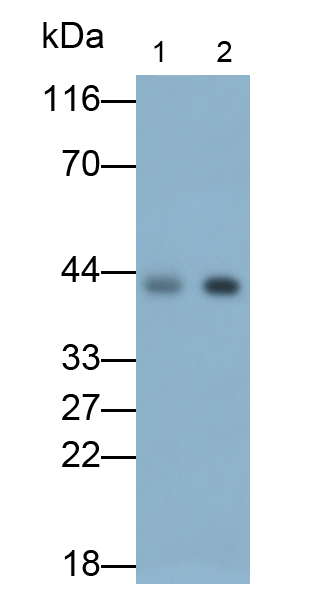 Polyclonal Antibody to Creatine Kinase, Muscle (CKM)