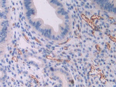 Polyclonal Antibody to Oncostatin M (OSM)