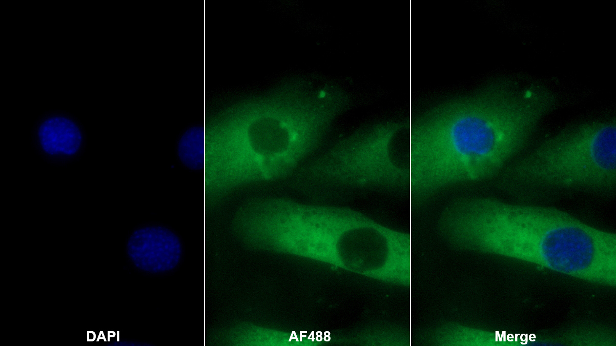Polyclonal Antibody to Prokineticin 2 (PK2)