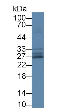 Polyclonal Antibody to Superoxide Dismutase 3, Extracellular (SOD3)