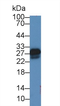 Polyclonal Antibody to Superoxide Dismutase 3, Extracellular (SOD3)