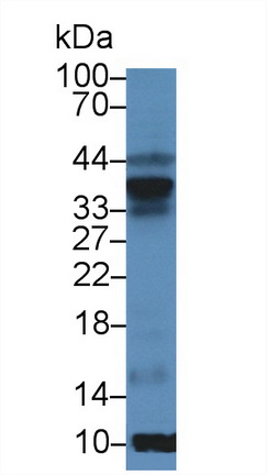 Polyclonal Antibody to Superoxide Dismutase 3, Extracellular (SOD3)