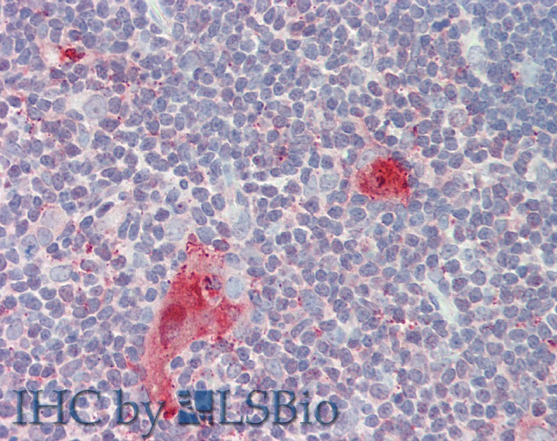 Polyclonal Antibody to Cluster Of Differentiation 30 Ligand (CD30L)