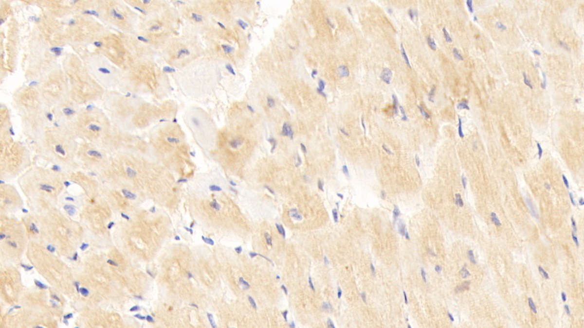 Polyclonal Antibody to Cluster Of Differentiation 40 Ligand (CD40L)