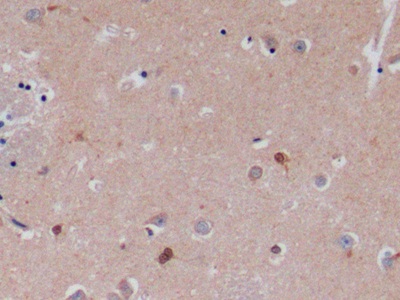 Polyclonal Antibody to Stem Cell Factor Receptor (SCFR)