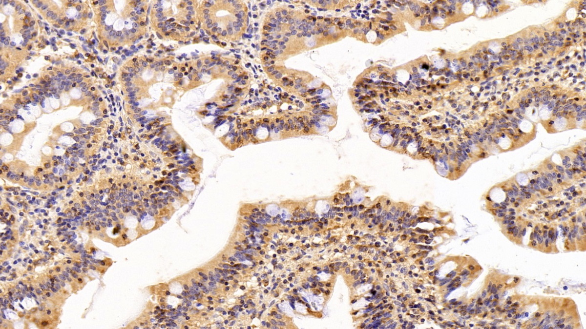 Polyclonal Antibody to Transforming Growth Factor Alpha (TGFa)