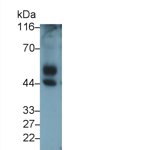 Polyclonal Antibody to Transforming Growth Factor Beta 1 (TGFb1)