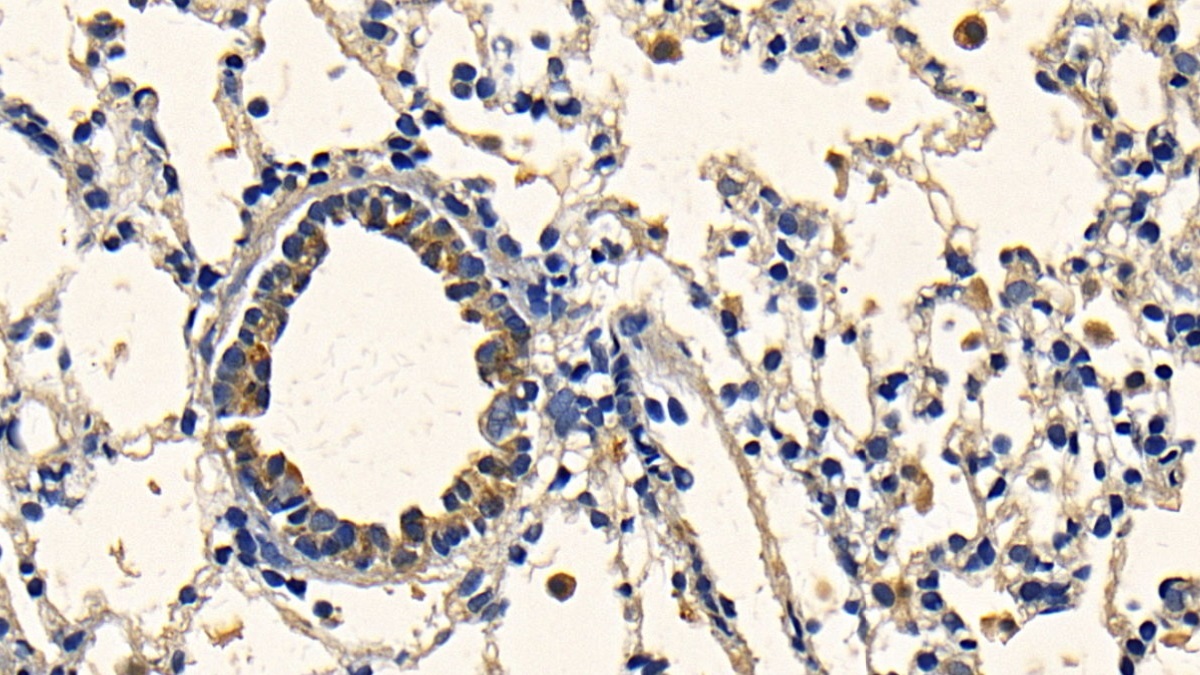 Polyclonal Antibody to Transforming Growth Factor Beta 1 (TGFb1)