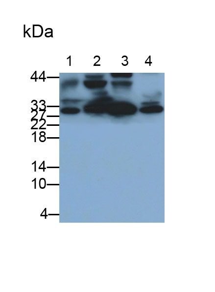 Polyclonal Antibody to Tissue Inhibitors Of Metalloproteinase 2 (TIMP2)