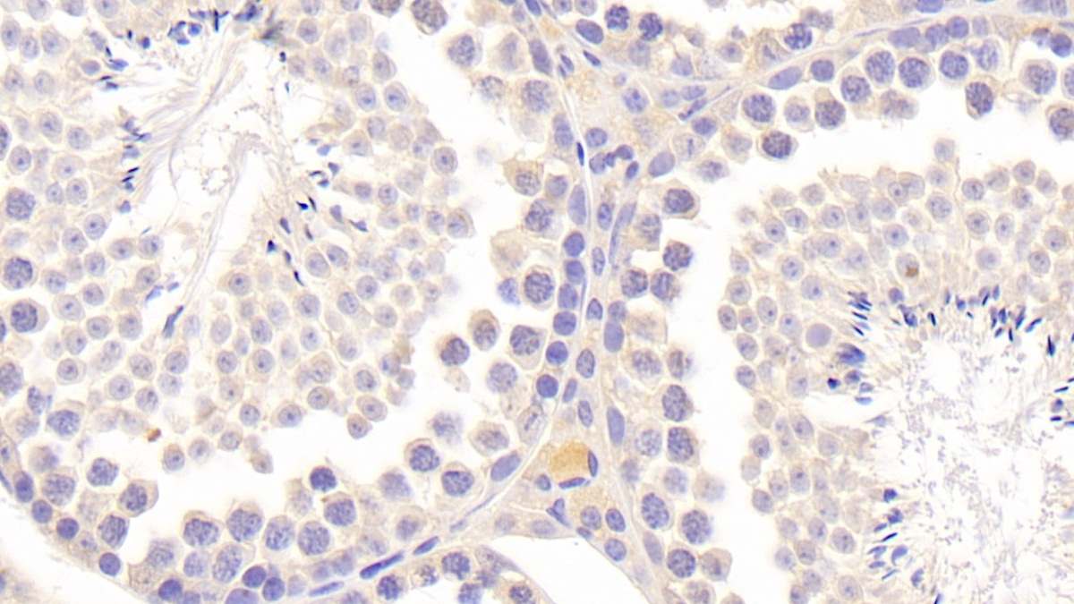 Polyclonal Antibody to Tissue Inhibitors Of Metalloproteinase 2 (TIMP2)