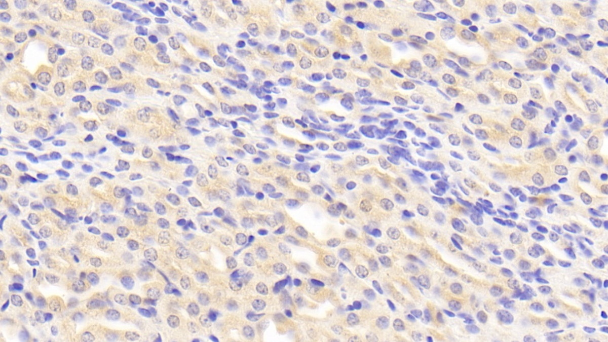 Polyclonal Antibody to Tissue Inhibitors Of Metalloproteinase 2 (TIMP2)