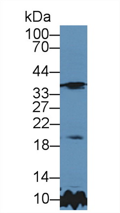 Polyclonal Antibody to Tissue Inhibitors Of Metalloproteinase 3 (TIMP3)