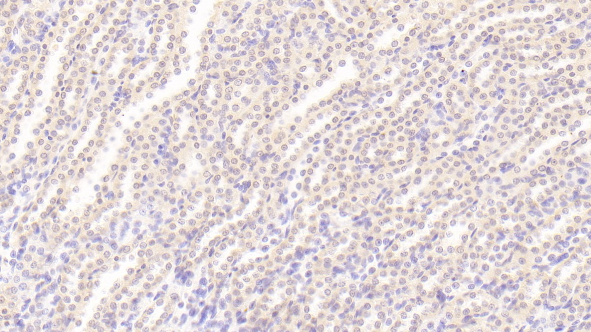 Polyclonal Antibody to Tissue Inhibitors Of Metalloproteinase 3 (TIMP3)