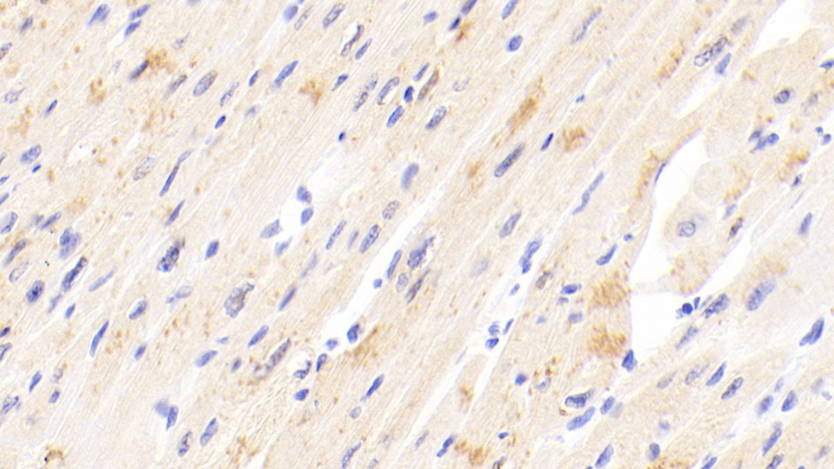 Polyclonal Antibody to Tissue Inhibitors Of Metalloproteinase 4 (TIMP4)