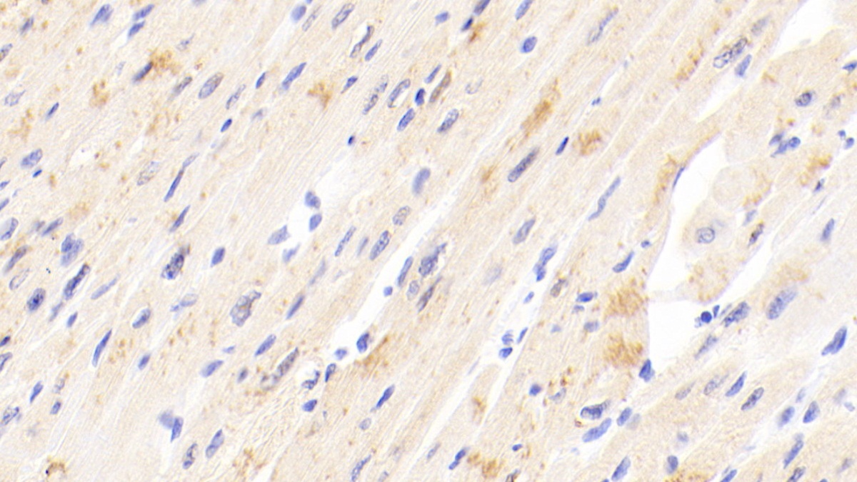 Polyclonal Antibody to Tissue Inhibitors Of Metalloproteinase 4 (TIMP4)