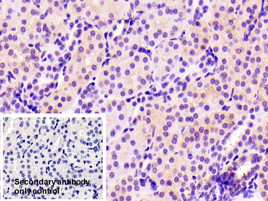 Polyclonal Antibody to Tissue Inhibitors Of Metalloproteinase 4 (TIMP4)