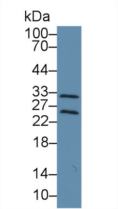 Polyclonal Antibody to Tissue Inhibitors Of Metalloproteinase 4 (TIMP4)