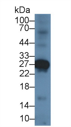 Polyclonal Antibody to Tissue Inhibitors Of Metalloproteinase 4 (TIMP4)