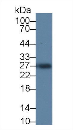 Polyclonal Antibody to Tissue Inhibitors Of Metalloproteinase 4 (TIMP4)