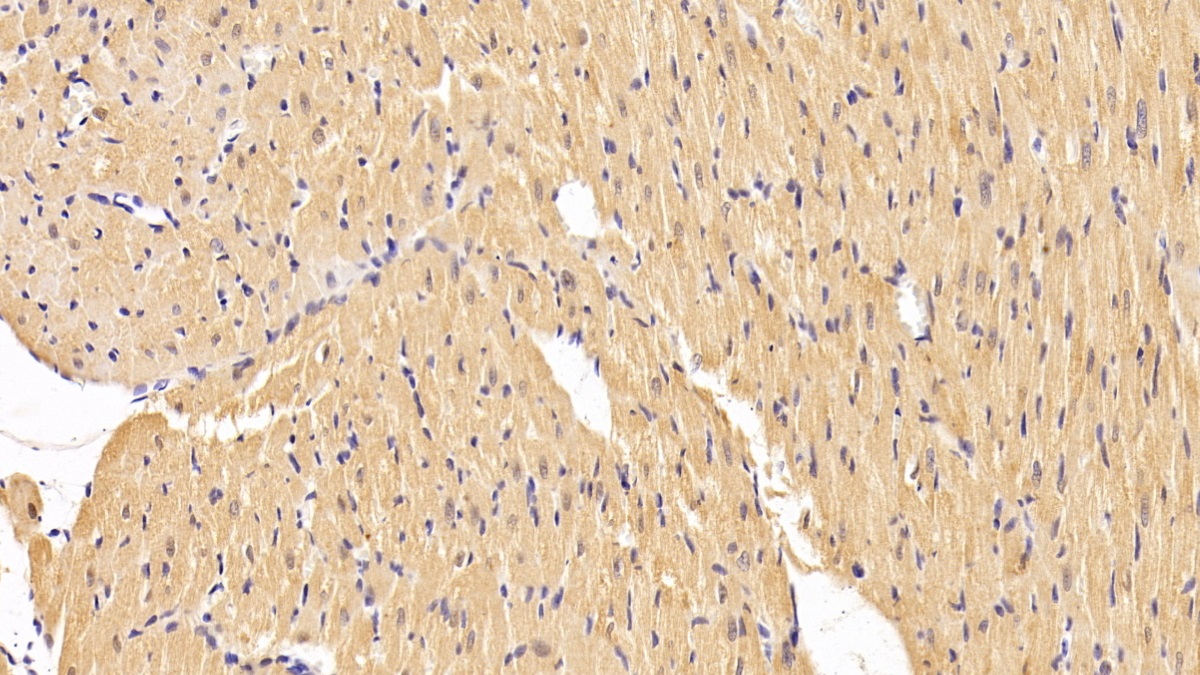 Polyclonal Antibody to Tissue Inhibitors Of Metalloproteinase 4 (TIMP4)