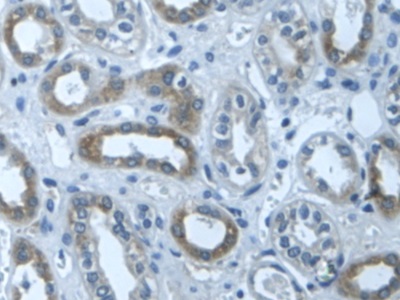 Polyclonal Antibody to Transforming Growth Factor Beta Induced Protein (TGFbI)