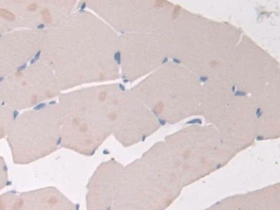 Polyclonal Antibody to Adiponectin Receptor 2 (ADIPOR2)