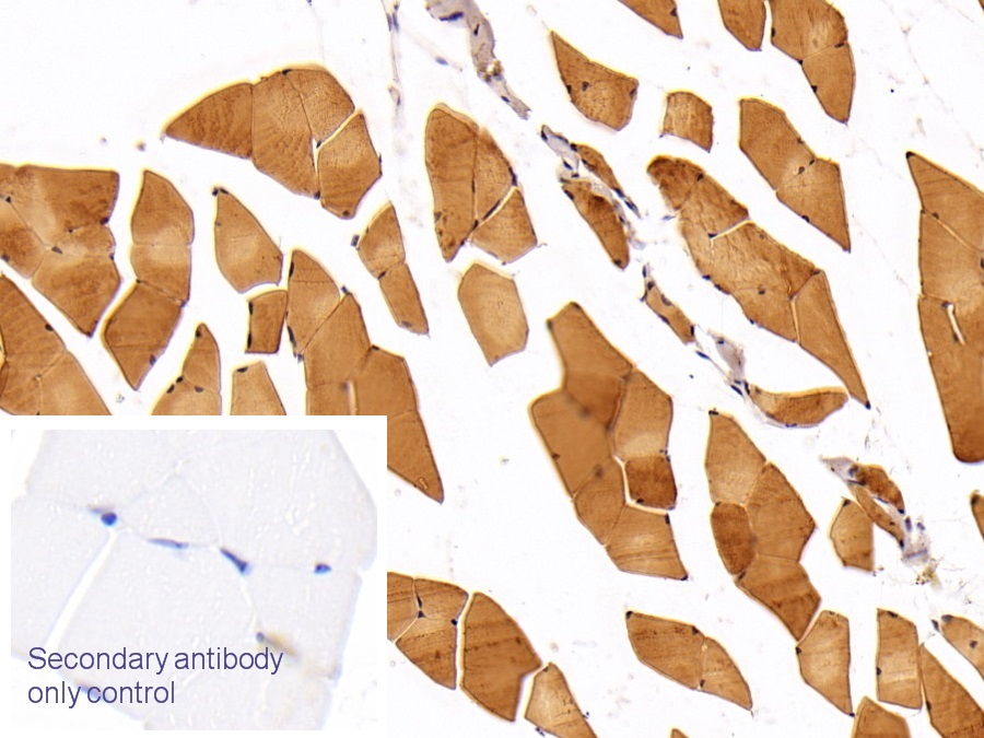 Polyclonal Antibody to Adiponectin Receptor 2 (ADIPOR2)