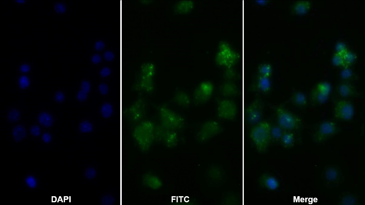 Polyclonal Antibody to Tumor Necrosis Factor Alpha (TNFa)
