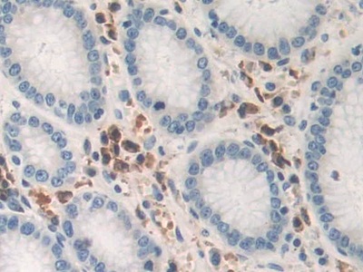 Polyclonal Antibody to Tumor Necrosis Factor Alpha (TNFa)