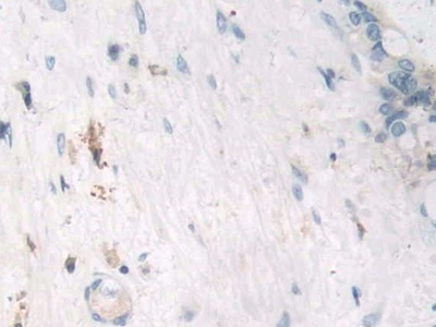 Polyclonal Antibody to Tumor Necrosis Factor Alpha (TNFa)