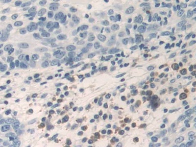 Polyclonal Antibody to Tumor Necrosis Factor Alpha (TNFa)