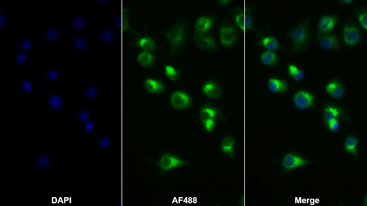 Polyclonal Antibody to Tumor Necrosis Factor Alpha (TNFa)