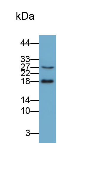 Polyclonal Antibody to Tumor Necrosis Factor Alpha (TNFa)